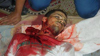 إصابة مواطن بطلق ناري في الشيخ زويد أثناء اشتباك الأمن مع إرهابيين