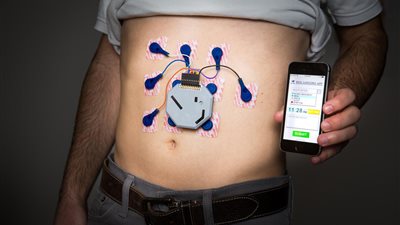 جهاز يمكن ارتداؤه على المعدة لتشخيص أمراض الجهاز الهضمي