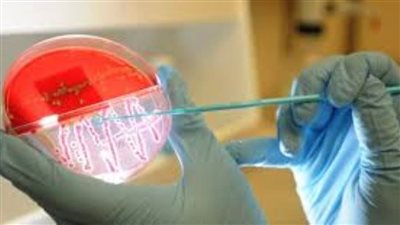 شروط إجراء مزرعة بول أو دم