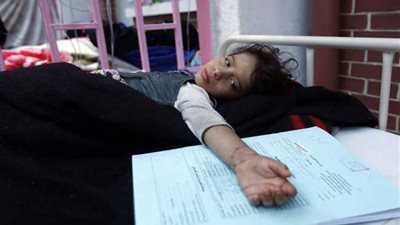 الصحة العالمية ترصد وفاة 84 شخصا بـ«الدفتيريا» في اليمن