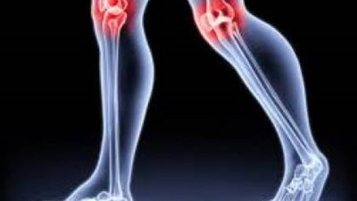 تصنيع مفاصل للركبة بتقنية الطباعة ثلاثية الأبعاد في دبي