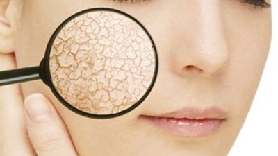 ماسك طبيعي للبشرة الجافة