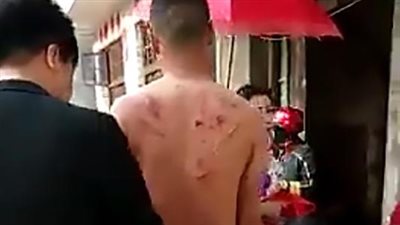 مقلب قاسٍ لجلد عريس ورش الملح على جروحه (فيديو)