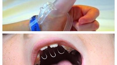 7 طرق تخلص طفلك من عادة مص الإصبع