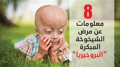 8 معلومات عن مرض الشيخوخة المبكرة 