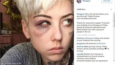 بالصور.. فنانة أمريكية تتعرض للضرب بعد رسمها لوحة لـ«ترامب» عاريا