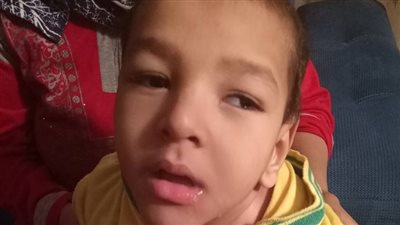 بالصور.. مطالب بعلاج طفل مصاب بضمور في المخ