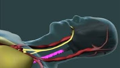 «لجنة زراعة الأعضاء» تناقش اليوم تحديد معايير «وفاة جذع المخ»