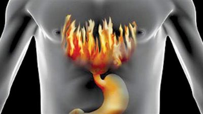 ما الفرق بين ارتجاع المريء وحموضة المعدة ؟