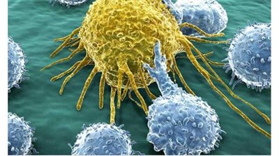 أسباب مرض السرطان.. تعرف على التفسير العلمي للإصابة