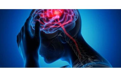 أعراض وأسباب السكتة الدماغية وطرق الوقاية منها | فيديو