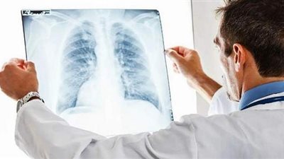 بسبب خسارة لعبة فيديو.. انفجار رئة مواطن صيني بمقاطعة فوجيان