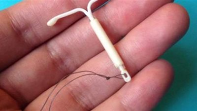 اعراض الحمل على اللولب