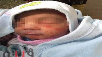 قصة طفل رضيع نهشه النمل في الشرقية