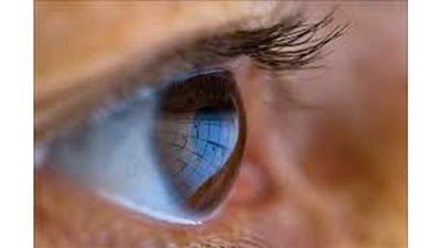 المياه الزرقاء في العين .. أهم الأعراض وكيفية علاجها؟