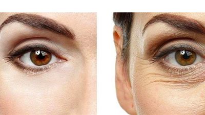 هل يجوز إجراء عمليات تجميل لإزالة تجاعيد الوجه؟