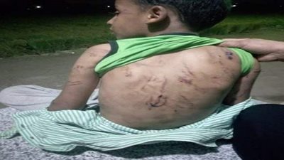 التفاصيل الكاملة وراء تعذيب زوج الأم لأطفال زوجته بقليوب.. الجيران تكشف اللغز .. الأم : كان يرفض وجودهما.. والزوج : كنت بأدبهم