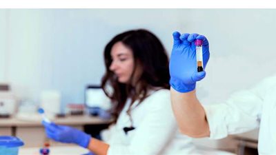 أعراض أنيميا الفول وأسباب الإصابة وطرق الوقاية والعلاج