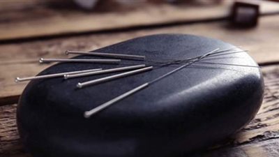 الإبر الصينية .. أنواعها وكيف تعمل على علاج الألم