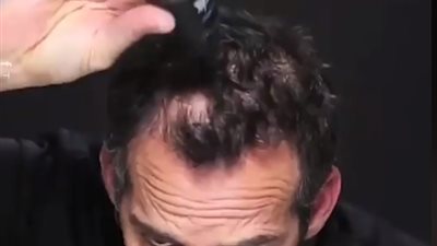 أحدث ابتكار لملء فراغات الشعر (فيديو)