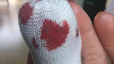 باب يقطع إصبع معلمة وكلبها يتناول الجزء المقطوع (صور)