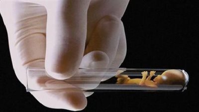 لماذا يلجأ الأزواج إلى عمليات أطفال الأنابيب؟