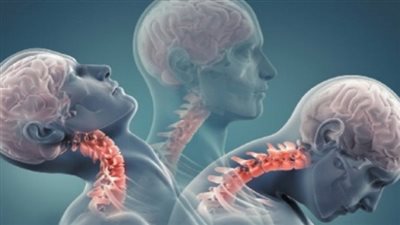 تقنية تصوير جديدة ثلاثية الأبعاد لعلاج أمراض العضلات