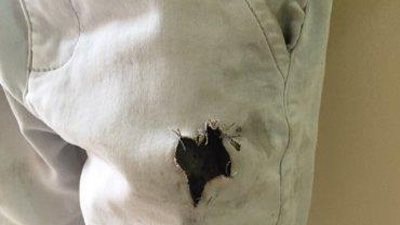 بالصورة.. طفل سعودي ينجو بأعجوبة من انفجار «آيفون 6» في ملابسه