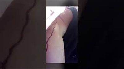 فتاة سعودية تكشف تفاصيل تعرضها للضرب المبرح من قبل والدها (فيديو)