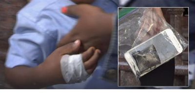 إصابة طفل بحروق بسبب انفجار بطارية هاتف «جالاكسي كور» في يده