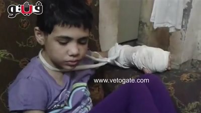 بالفيديو.. الطفلة المعذبة بالمكواة على يد زوجة أبيها لـ«فيتو»: شوفت لحمي بيتبخر ومرات أبويا كاتمة نفسي.. جارة الضحية: جلدها كان بيقع قدامي وأجبروها تغسل المواعين.. والمتهمة: البنت بتعمل حاجا