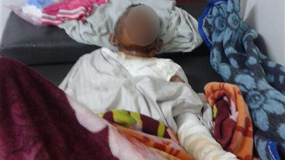والد طفل الحرق بالشرقية: «ابني مالوش في الكورة واتاخد غدر» (فيديو)