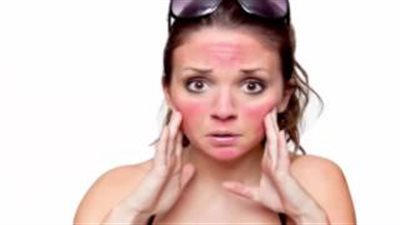 بالفيديو.. وصفة طبيعية لحماية بشرتك من حروق الشمس