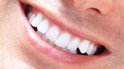 5 عادات تتسبب في تدمير الأسنان