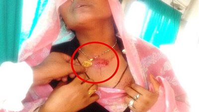 بالصور.. «عقد» ينقذ حياة شابة مسلمة أطلق شقيقها النار عليها في الهند