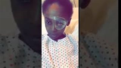 إصابة طفلة في عينها بسبب الألعاب النارية (فيديو)