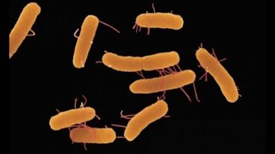 أعراض وأسباب السالمونيلا وطرق العلاج