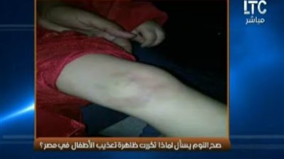 الغيطي يبرز صور «فيتو»: مدير مدرسة يعتدي على طالب بسبب هاتف محمول