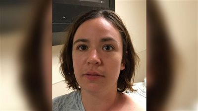 بالصور.. العثور على سيدة بأقدام ملتصقة تدعي أنها حورية بحر