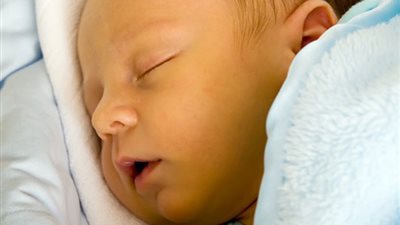 دراسة بالقومي للبحوث: إصابة حديثي الولادة بالصفراء بنسبة 50%