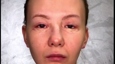 بالفيديو.. فنانة تحول فتيات مشوهات الوجه إلى ملكات جمال