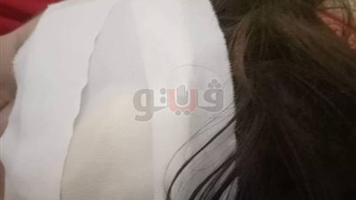 إصابة تلميذ بجرح في الوجه داخل مدرسة بدمياط