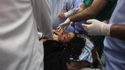 إصابة فتاة بسبب سقوطها من سلم منزل بالقليوبية