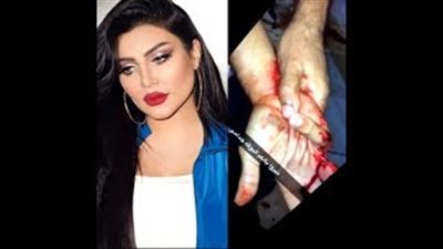 بالفيديو.. فنانة كويتية توثق لحظة سرقة سعودي في لندن بطريقة مروعة