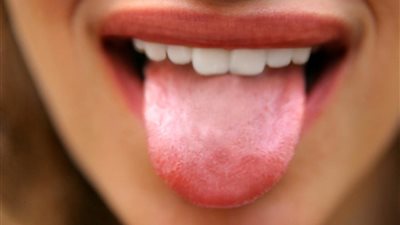 أسباب حساسية اللسان وطرق الوقاية منها