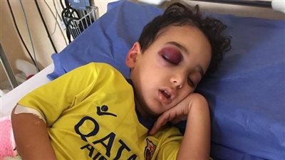 التقرير الطبي لطفل «ههيا» المصاب بطلق ناري طائش في الشرقية