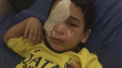 التحفظ على كاميرات مراقبة «كافيه» في واقعة إصابة طفل الشرقية بالرصاص