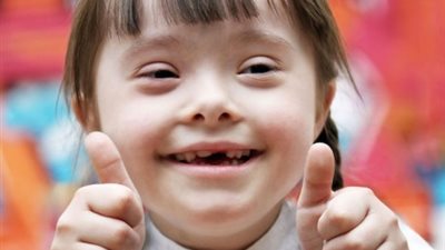 5 أسباب تؤدي إلى إصابة طفلك بـ«متلازمة داون»