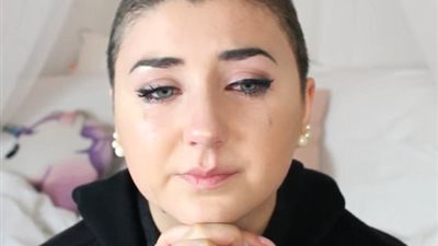 بالصور.. شاهد ما حدث لفتاة استخدمت بلسما على شعرها المصبوغ