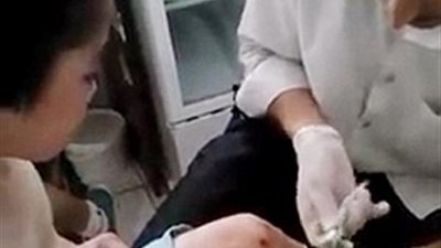 بالصور.. طفل يدافع عن والدته بعد أن ضربته وأحرقته